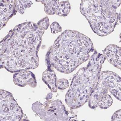 Immunohistochemistry-Paraffin: TMEM130 Antibody [NBP1-84099]