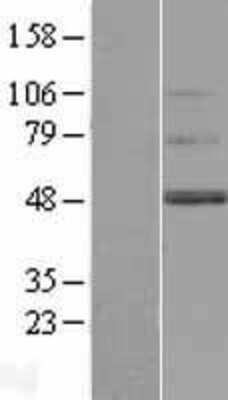 Western Blot: TMEM130 Overexpression Lysate [NBL1-17009]