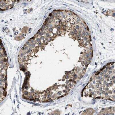 Immunohistochemistry: TMEM131 Antibody [NBP1-86590]