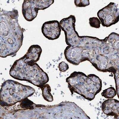 Immunohistochemistry: TMEM131 Antibody [NBP1-86591]