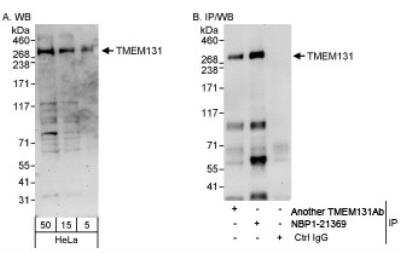 Western Blot: TMEM131 Antibody [NBP1-21369]