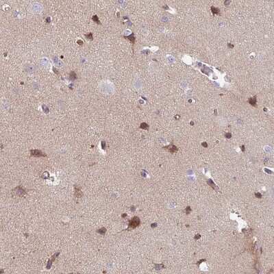 Immunohistochemistry-Paraffin: TMEM132A Antibody [NBP2-14753]