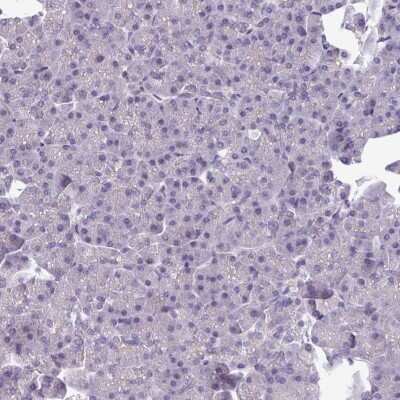 Immunohistochemistry-Paraffin: TMEM132A Antibody [NBP2-14753]