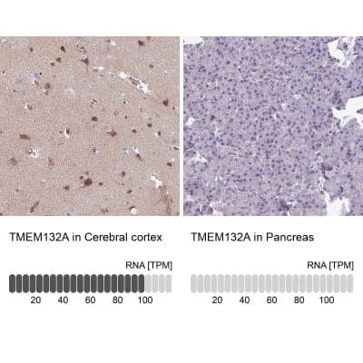 Immunohistochemistry-Paraffin: TMEM132A Antibody [NBP2-14753]