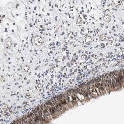 Immunohistochemistry-Paraffin: TMEM132B Antibody [NBP2-38259]