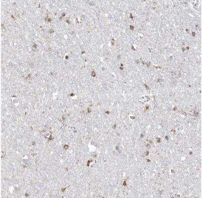 Immunohistochemistry-Paraffin: TMEM132B Antibody [NBP1-93575]