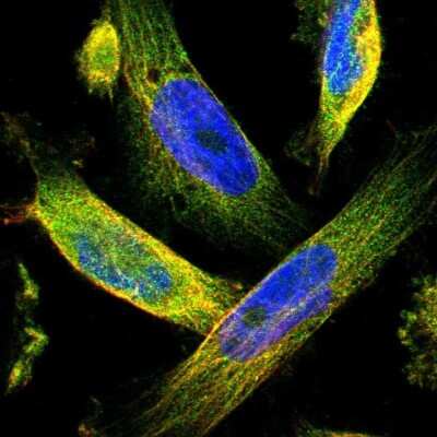 Immunocytochemistry/ Immunofluorescence: TMEM132C Antibody [NBP1-90498]