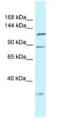 Western Blot: TMEM132D Antibody [NBP1-91366]