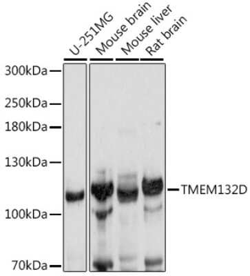 Western Blot: TMEM132D AntibodyAzide and BSA Free [NBP2-93918]