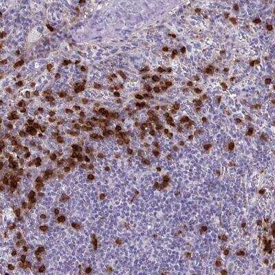 Immunohistochemistry-Paraffin: TMEM133 Antibody [NBP2-31829]