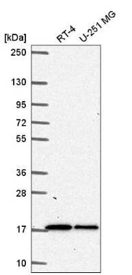 Western Blot: TMEM133 Antibody [NBP2-56281]