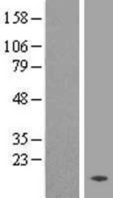 Western Blot: TMEM133 Overexpression Lysate [NBL1-17010]