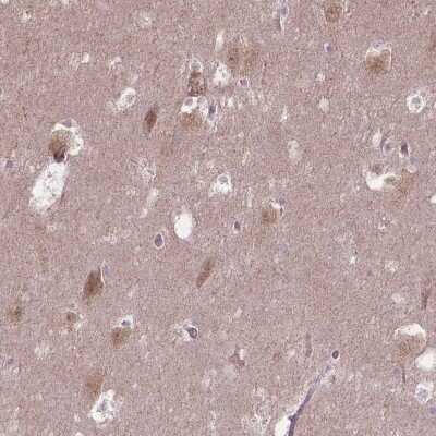 Immunohistochemistry: TMEM135 Antibody [NBP2-49601]