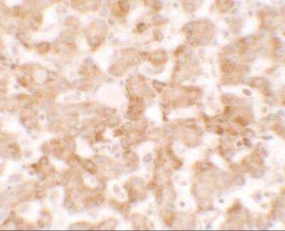 Immunohistochemistry: TMEM135 Antibody - BSA Free [NBP2-81869]