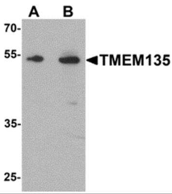 Western Blot: TMEM135 AntibodyBSA Free [NBP2-81869]