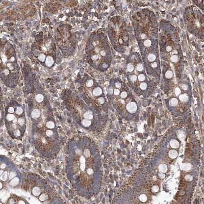 Immunohistochemistry-Paraffin: TMEM139 Antibody [NBP1-83439]