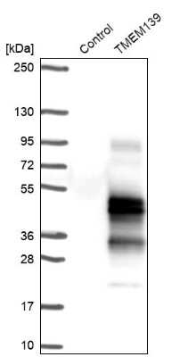 Western Blot: TMEM139 Antibody [NBP1-83439]