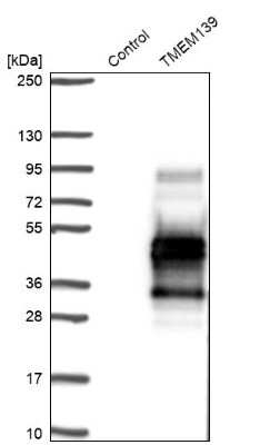 Western Blot: TMEM139 Antibody [NBP2-38340]