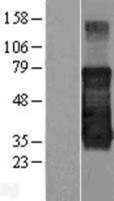 Western Blot: TMEM139 Overexpression Lysate [NBP2-05258]