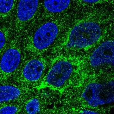Immunocytochemistry/ Immunofluorescence: TMEM141 Antibody [NBP1-81207]