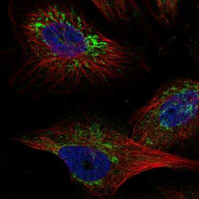 Immunocytochemistry/ Immunofluorescence: TMEM141 Antibody [NBP2-55632]