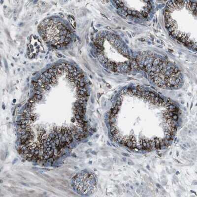 Immunohistochemistry-Paraffin: TMEM141 Antibody [NBP1-81207]
