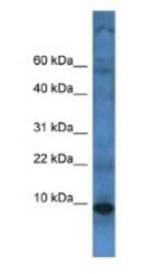 Western Blot: TMEM141 Antibody [NBP1-79868]