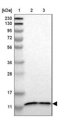 Western Blot: TMEM141 Antibody [NBP1-81207]