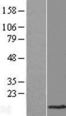 Western Blot: TMEM141 Overexpression Lysate [NBL1-17015]