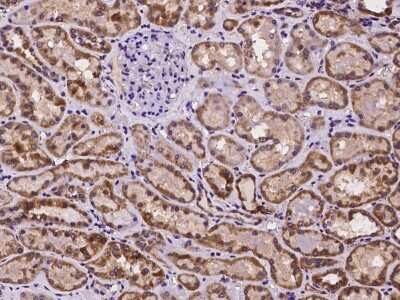 Immunohistochemistry-Paraffin: TMEM143 Antibody [NBP2-98096]