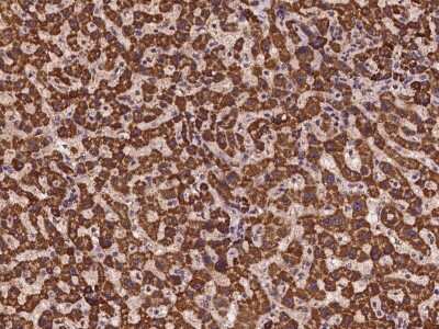 Immunohistochemistry-Paraffin: TMEM143 Antibody [NBP2-98096]