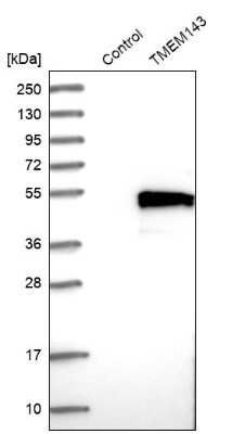 Western Blot: TMEM143 Antibody [NBP1-83809]