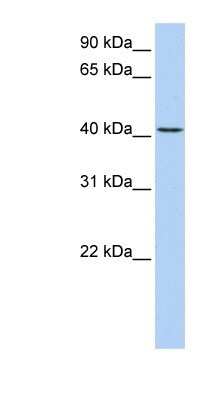 Western Blot: TMEM144 Antibody [NBP1-91310]