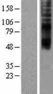 Western Blot: TMEM144 Overexpression Lysate [NBP2-04371]