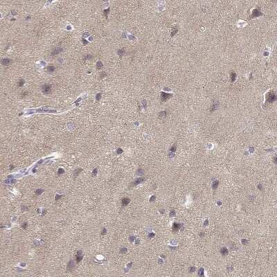 Immunohistochemistry-Paraffin: TMEM145 Antibody [NBP2-57030]