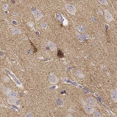 Immunohistochemistry-Paraffin: TMEM145 Antibody [NBP2-57030]