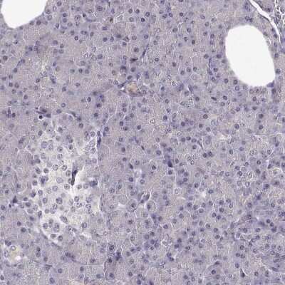 Immunohistochemistry-Paraffin: TMEM145 Antibody [NBP2-57030]