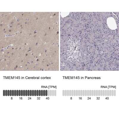 Immunohistochemistry-Paraffin: TMEM145 Antibody [NBP2-57030]