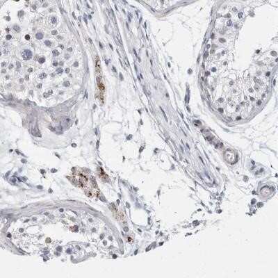 Immunohistochemistry-Paraffin: TMEM146 Antibody [NBP1-93475]