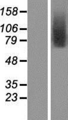 Western Blot: TMEM146 Overexpression Lysate [NBP2-05308]