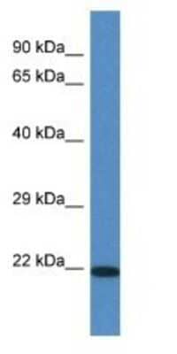 Western Blot: TMEM147 Antibody [NBP1-79334]