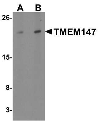 Western Blot: TMEM147 AntibodyBSA Free [NBP2-82028]