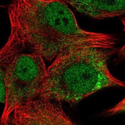 Immunocytochemistry/ Immunofluorescence: TMEM14A Antibody [NBP2-56394]