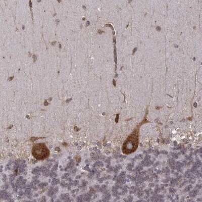 Immunohistochemistry-Paraffin: TMEM14A Antibody [NBP2-56394]