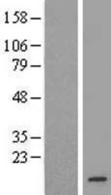Western Blot: TMEM14B Overexpression Lysate [NBL1-17021]