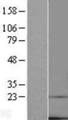 Western Blot: TMEM14C Overexpression Lysate [NBL1-17022]