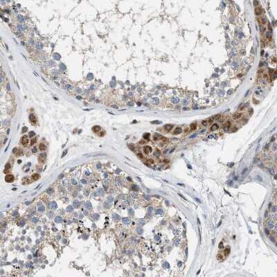 Immunohistochemistry-Paraffin: TMEM150A Antibody [NBP1-81885]