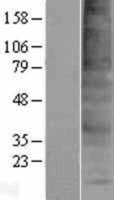 Western Blot: TMEM150A Overexpression Lysate [NBP2-08593]