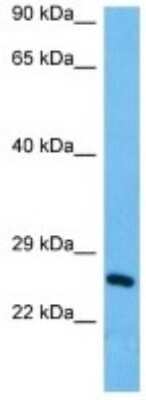 Western Blot: TMEM150B Antibody [NBP3-10200]