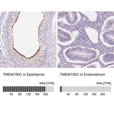 Immunohistochemistry-Paraffin: TMEM150C Antibody [NBP2-30558]